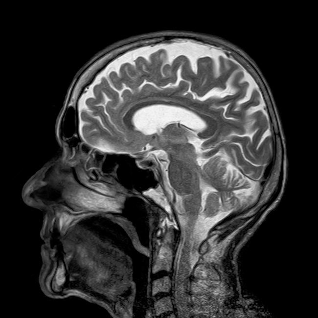 Osteopathy-MRI Osteopathy-MRI