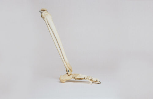 Osteopathy-Joint
